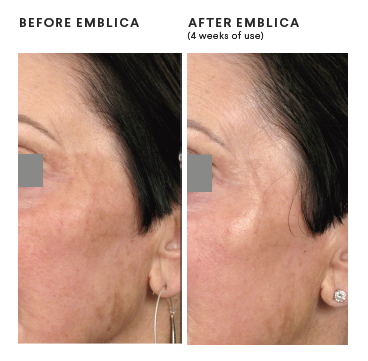 4 weeks of Emblica